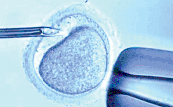 Image: In vitro fertilization of the oocyte (Photo courtesy of Dr. Geoffrey Sher).