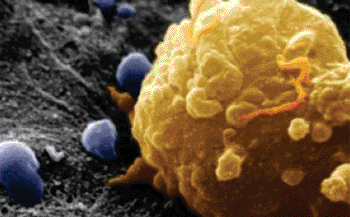 Image: Scanning electron micrograph of a melanoma cell. BRAF fusion genes in pan-negative melanomas may render them sensitive to MEK inhibitors (Photo courtesy of Vanderbilt University).