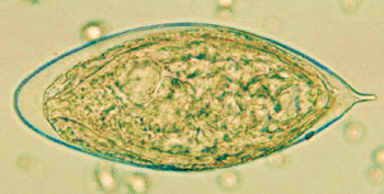 Image: Schistosoma haematobium egg in a wet mount of urine concentrates, showing the characteristic terminal spine (Photo courtesy of Centers for Disease Control and Prevention).