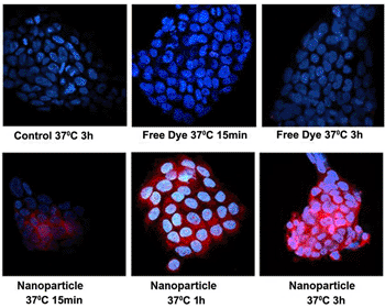 Image: Cellular uptake of nanoparticles encapsulating both dye and luteolin (Photo courtesy of Winship Cancer Institute of Emory University).