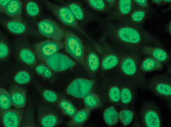 Image: Fluorescence antinuclear antibody speckled pattern staining (Photo courtesy of the Autoantibody Standardization Committee).