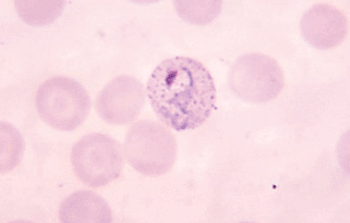 Микрофотография показывает растущий трофозоит Plasmodium vivax в мазке крови (фото любезно предоставлено Центром США по контролю и профилактике заболеваний). Микрофотография показывает растущий трофозоит Plasmodium vivax в мазке крови (фото любезно предоставлено Центром США по контролю и профилактике заболеваний).