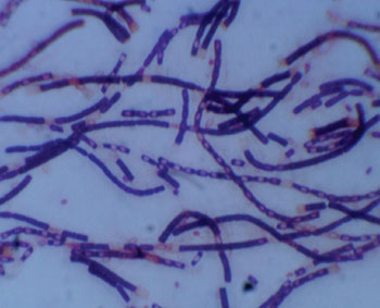 Бактерии сибирской язвы - Bacillus anthracis, передающиеся, в основном, через органы дыхания или повреждения кожи (фото любезно предоставлено Миссурийским университетом). Бактерии сибирской язвы - Bacillus anthracis, передающиеся, в основном, через органы дыхания или повреждения кожи (фото любезно предоставлено Миссурийским университетом).