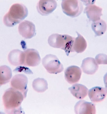 Image: A micrograph of a Giemsa-stained thin blood film showing a heavy infection of ring-forms and gametocytes of Plasmodium falciparum (Photo courtesy of Centers for Disease Control and Prevention).