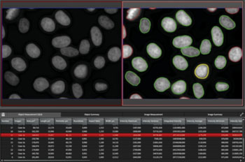 Image: Leica Application Suite Advanced fluorescence (LAS AF) 4.0 is a software platform for advanced life science research in wide-field and confocal microscopy. The image shows the 2D Analysis Module used to count nuclei automatically (Photo courtesy of Leica Microsystems).