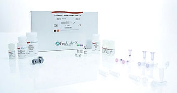 Image: The PAXgene Blood RNA Kit for the extraction of intracellular ribonucleic acid (Photo courtesy of Qiagen).