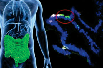 Image: Human gastrointestinal cells from patients were engineered to express insulin (fluorescent green) in the laboratory (Photo courtesy of Columbia University).