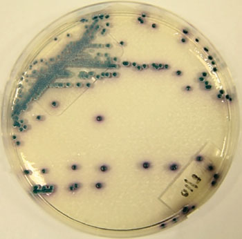 Image: Candida tropicalis growing on specific CHROMagar culture media (Photo courtesy of Takamasa Kaneko).