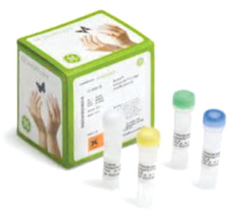 Image: The illustra Single Cell GenomiPhi DNA amplification kit (Photo courtesy of GE Healthcare Life Sciences).