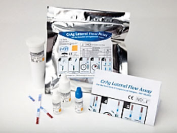 图片A：IMMY CrAg LFA是一种隐球菌抗原侧流测定（图片蒙Immuno-Mycologics公司惠赐）。