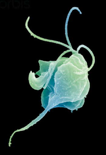 图片:一只阴道毛滴虫滋养体的扫描电子显微图像(SEM)(图片蒙Dennis Kunkel博士惠赐)。 图片:一只阴道毛滴虫滋养体的扫描电子显微图像(SEM)(图片蒙Dennis Kunkel博士惠赐)。