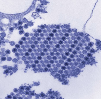 Image: Digitally-colorized transmission electron micrograph (TEM) depicts numerous Chikungunya virus particles, which are composed of a central dense core that is surrounded by a viral envelope. Each virion is approximately 50 nm in diameter (Photo courtesy of Cynthia Goldsmith).