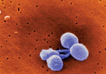 Image: Scanning Electron Micrograph of Streptococcus pneumoniae by R. Facklam, J. Carr. Cerebrospinal fluid (CSF) β-2 transferrin detection decreases after inoculation with live or ciprofloxacin-inactived S. pneumoniae. This may be due to passive adsorption via distinctive features of the S. pneumoniae cell wall not present in the other bacterial species examined (Photo courtesy of MicrobeWiki and the CDC – [US] Centers for Disease Control and Prevention).