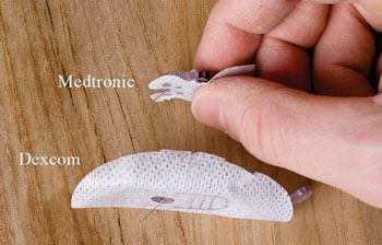 Сравнение двух популярных датчиков непрерывного мониторинга глюкозы (CGM). Фото любезно предоставлено Broken Pancreas. Сравнение двух популярных датчиков непрерывного мониторинга глюкозы (CGM). Фото любезно предоставлено Broken Pancreas.
