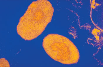 Снимок возбудителя коклюша, бактерии Bordetella pertussis, полученный с помощью электронного микроскопа (фото публикуется с разрешения Санофи Пастера (Sanofi Pasteur)). Снимок возбудителя коклюша, бактерии Bordetella pertussis, полученный с помощью электронного микроскопа (фото публикуется с разрешения Санофи Пастера (Sanofi Pasteur)).