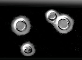 Image: Photomicrograph of Cryptococcus neoformans, encapsulated yeast, showing the polysaccharide capsule (Photo courtesy of Dr. L. Gross).