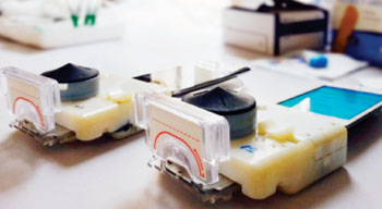 Image: Newly developed diagnostic smartphone accessory device successfully performed point-of-care HIV and syphilis tests in Rwanda from finger-prick whole blood in 15 minutes, operated by healthcare workers easily trained via a software app (Photo courtesy of Samiksha Nayak for Columbia Engineering).