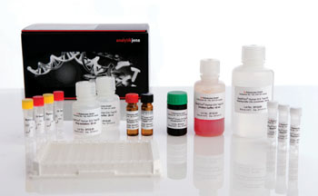 Image: Two CE-IVD marked tau protein immunoassay kits, hTAU total ELISA kit and pTAU rel ELISA, enable diagnosis of Alzheimer’s disease with specificity and sensitivity for patients with symptoms of dementia (Photo courtesy of Analytik Jena).