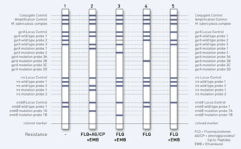 图片：用GenoType MTBDRsl快速检验诊断多药耐药肺结核(MDR-TB)也提供了有关进一步抗生素耐受性的信息（图片蒙Hain生命科学公司惠赐）。