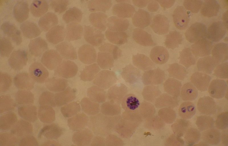 Image: Blood smear from a P. falciparum culture. Several red blood cells have ring stages inside them. Close to the center is a schizont and on the left a trophozoite (Photo courtesy of Wikimedia Commons).