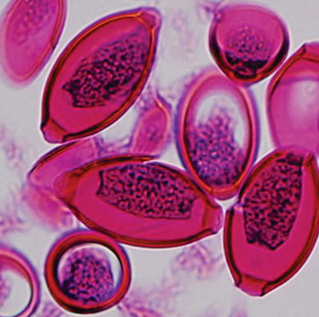 Image: Trichuris trichiura eggs inside a female worm from an infected individual (Photo courtesy of New York University).