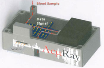Image: A prototype model of the AcµRay point-of-care diagnostic device (Photo courtesy of Emory University). Image: A prototype model of the AcµRay point-of-care diagnostic device (Photo courtesy of Emory University).