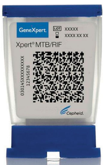 图片：Xpert MTB/RIF盒式全自动肺结核分子诊断检验（图片蒙Cepheid公司惠赐）。
