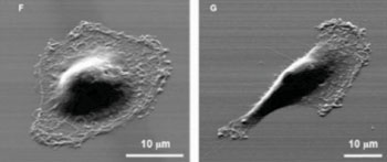 Image: Micrograph of individual cancer cells that were isolated according to their motility. The cell on the left is less likely to metastasize (Photo courtesy of University of Michigan).