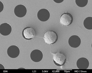 图片B:IBN液体活检微筛捕获的循环肿瘤细胞的显微图像(图片蒙生物工程与纳米技术学院惠赐)。 图片B:IBN液体活检微筛捕获的循环肿瘤细胞的显微图像(图片蒙生物工程与纳米技术学院惠赐)。