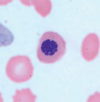 Image: A nucleated red blood cell in a thin blood smear (Photo courtesy of US Centers of Disease Control and prevention).