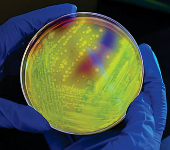 Желто-зеленая флуоресценция Clostridium difficile, высеянных на циклосерин-цефокситин-фруктозном агаре в чашке Петри (фото любезно предоставлено Центром по контролю и профилактике заболеваний).
