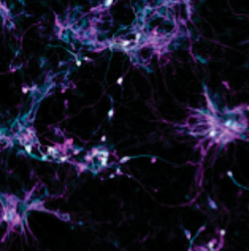 Image: A new technique enabled growth of aged brain cells from patients’ skin cells. The micrograph shows induced neurons that were directly converted from skin fibroblasts obtained from elderly human donors (Photo courtesy of the Salk Institute for Biological Studies).
