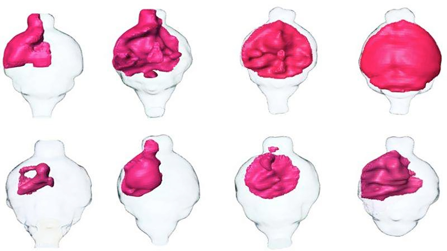 Image: MRI renderings of mouse brain tumors. Tumors treated with SKOG102 (lower panels) shrank by about half compared to tumors treated with a control (upper panels) (Photo courtesy of the University of California, San Diego).