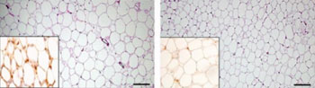 Image: Fat tissue cells are enlarged and more loosely packed in mice lacking perforin-rich dendritic cells (left) compared with the fat tissue of regular mice (right). Inset: crown-like structures within the fat tissue (left, dark brown) are associated with increased inflammation (Photo courtesy of the Weizmann Institute of Science).