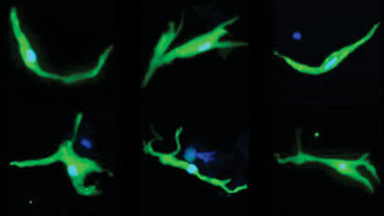 Image: Photomicrograph showing examples of individual pacemaker cells (Photo courtesy of Dr. Vasanth Vedantham, University of California, San Francisco).