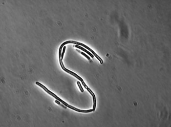 Image: Light micrograph of Bacillus cereus in a small colony variant (SCV) (Photo courtesy of Markus Kranzler/Vetmeduni Vienna).