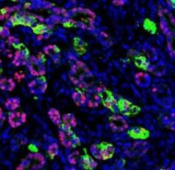 Image: Micrograph of functioning human pancreatic cells following transplantation into a mouse (Photo courtesy of Dr. Saiyong Zhu, University of California, San Francisco).