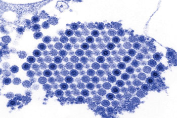 图片：大量屈公病毒颗粒的透射电子显微图片(TEM)，屈公病毒颗粒中间有一个致密的核心，周围包绕着病毒包膜（图片蒙Cynthia Goldsmith惠赐）。