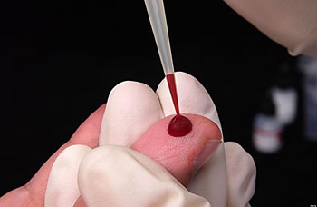 图片:穿刺手指取血常用于床旁自测(照片由The Health提供)。 图片:穿刺手指取血常用于床旁自测(照片由The Health提供)。