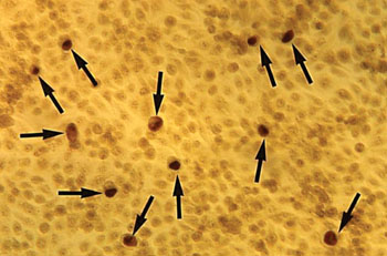 Image: Micrograph of a McCoy cell monolayer revealing a number of intracellular Chlamydia trachomatis inclusion bodies (arrowed); this assay is very complicated and takes a long time (Photo courtesy of the CDC - US Centers for Disease Control and Prevention).