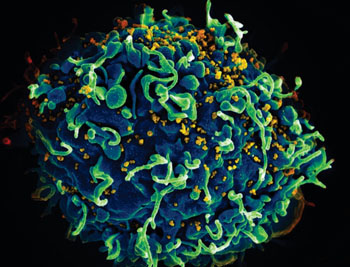 Image: The human T-cell (blue) under attack by human immunodeficiency viruses (yellow) (Photo courtesy of the US National Institute of Health).