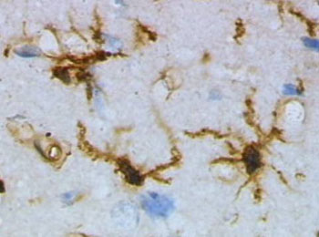 Image: Micrograph of microglia cells, which selectively express the TREM2 protein (Photo courtesy of Wikimedia Commons).