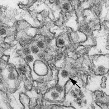 Image: Transmission electron micrograph (TEM) of Zika virus. Virus particles are 40 nanometers in diameter, with an outer envelope, and an inner dense core. The arrow points to a single virus particle (Photo courtesy of the CDC - US Centers for Disease Control and Prevention).