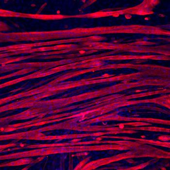 Image: Skeletal myotubes grown for three weeks on gelatin hydrogel (Photo courtesy of the McCain Laboratory, University of Southern California).