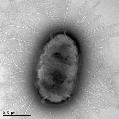 图片B：流行性H30大肠杆菌菌株的特写图像。Bar = 0.5微米（图片蒙华盛顿大学惠赐）。