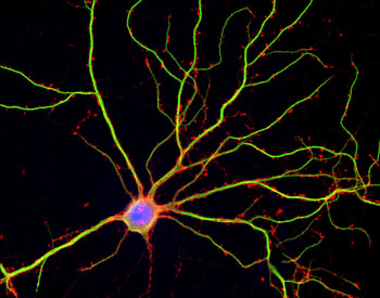 Image: A photomicrograph of a human neuron in culture (Photo courtesy of Shelley Halpain, University of California, San Diego).