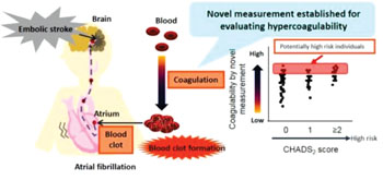 Image: A diagram showing the assessment of embolic stroke risk by measuring blood coagulability (Photo courtesy of the Department of Biofunctional Informatics, TMDU).