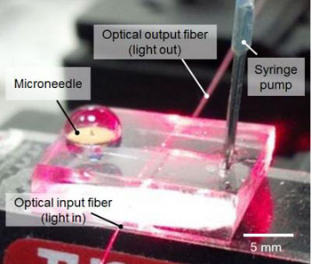 Image: A microneedle drug monitoring system painlessly collects interstitial fluid and analyzes it to determine the concentration of vancomycin in a patient\'s bloodstream (Photo courtesy of Sahan Ranamukhaarachchi, University of British Columbia).