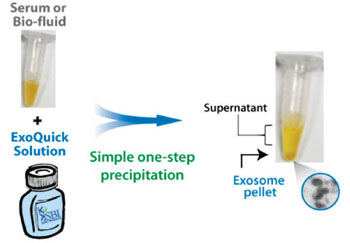 Image: The ExoQuick preparation method obtains high-quality exosomes from most biofluids using a protocol that can easily be performed on multiple samples and requires very low volumes of input sample (Photo courtesy of System Biosciences).