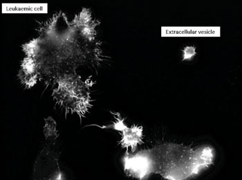 Микрофотография лейкозной клетки и внеклеточной везикулы (фото любезно предоставлено Манчестерским университетом).